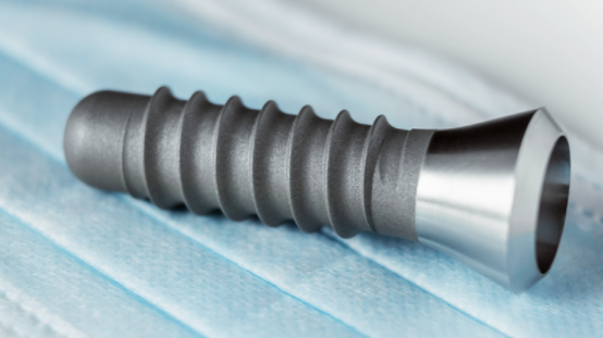 WHAT IS A DENTAL IMPLANT?